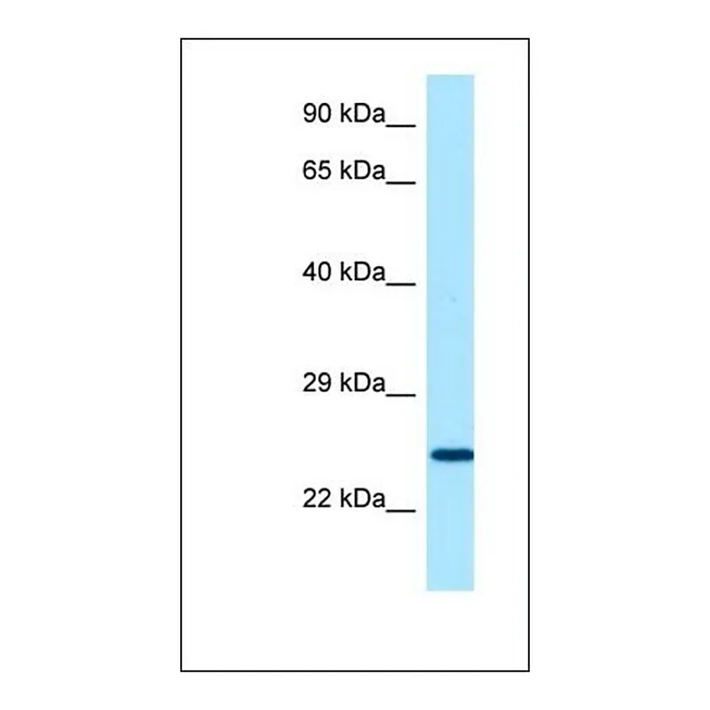 Merck Anti-SOSTDC1 antibody produced in rabbit