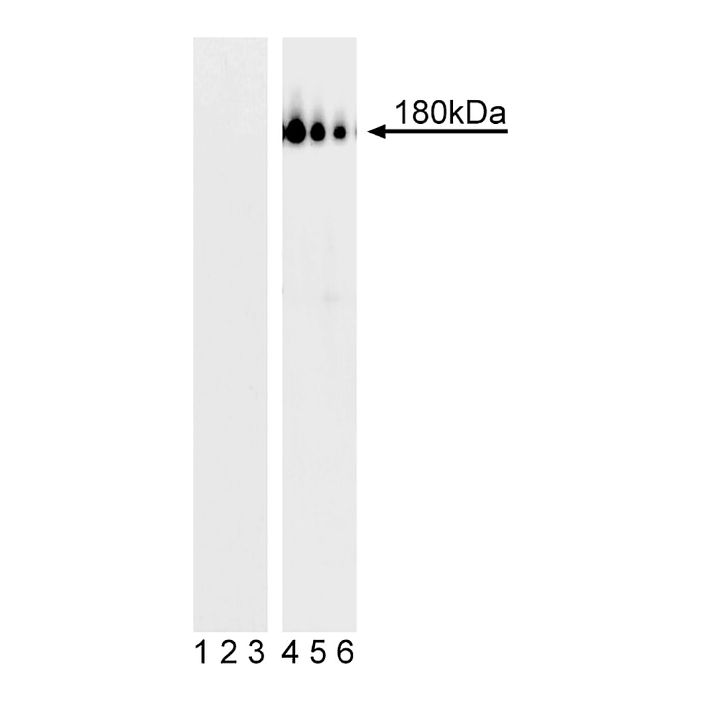 BD Purified Mouse anti-PDGFRβ (CD140b) (pY857)