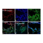 Thermo Fisher Scientific Donkey anti-Mouse IgG (H+L) ReadyProbes Secondary Antibody, Alexa Fluor 594
