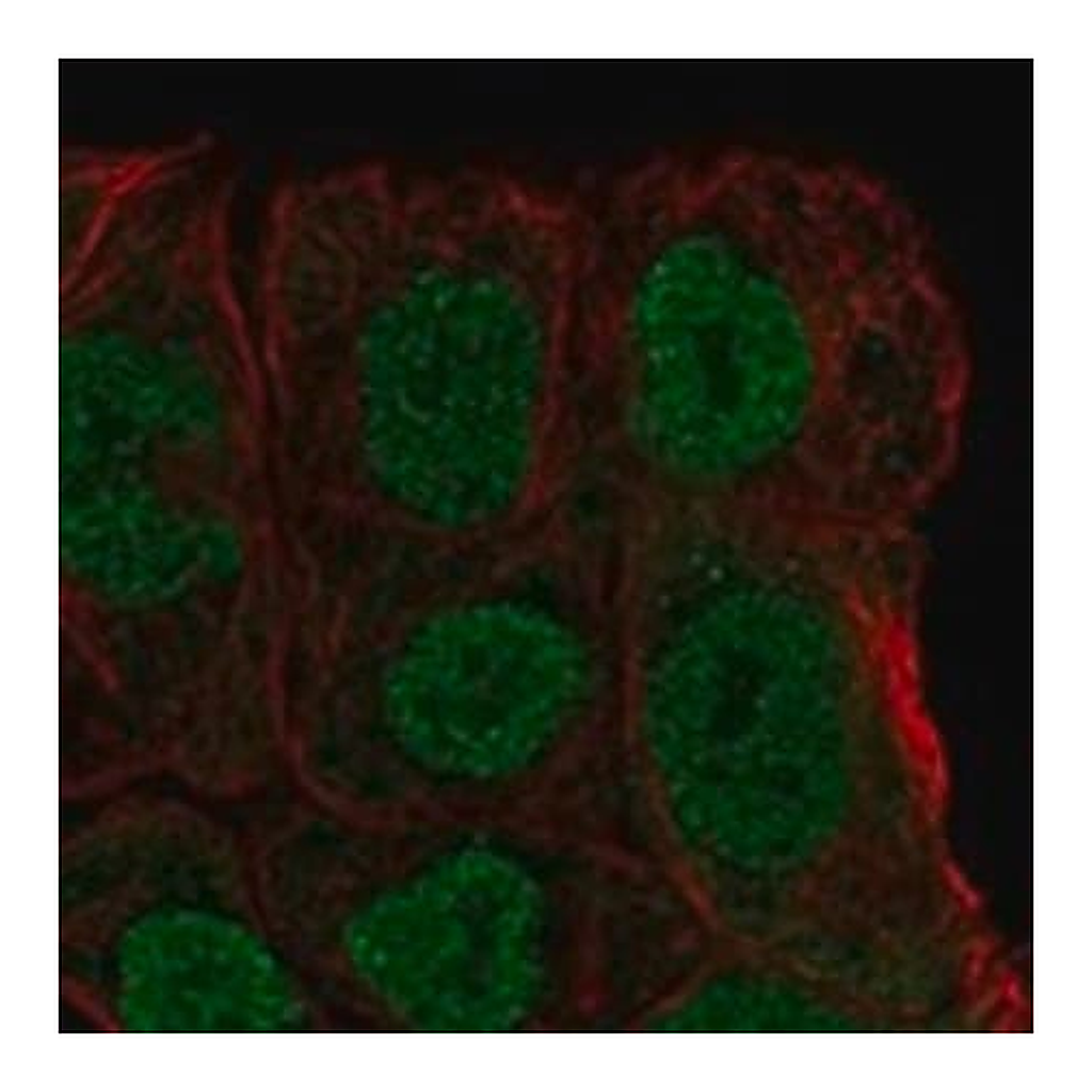 Merck Anti-MGAT4B antibody produced in rabbit