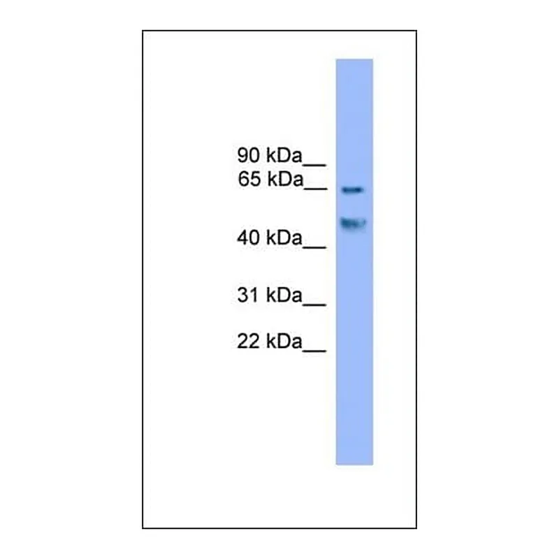 Merck Anti-RUNX2 antibody produced in rabbit