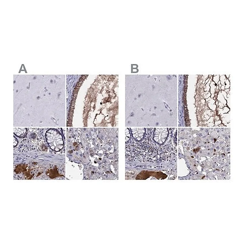 Merck Anti-SERPINA3 antibody produced in rabbit