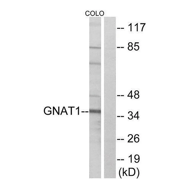 Merck Anti-GNAT1 antibody produced in rabbit
