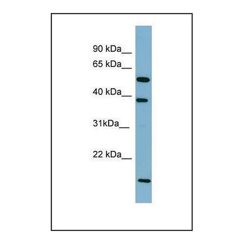 Merck Anti-SLC10A1
