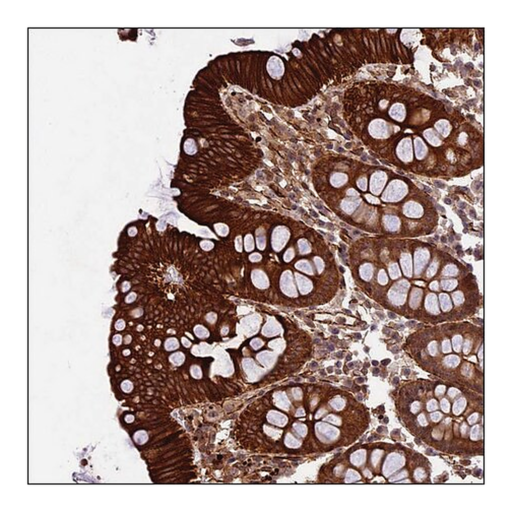 Merck Anti-CFAP53 antibody produced in rabbit