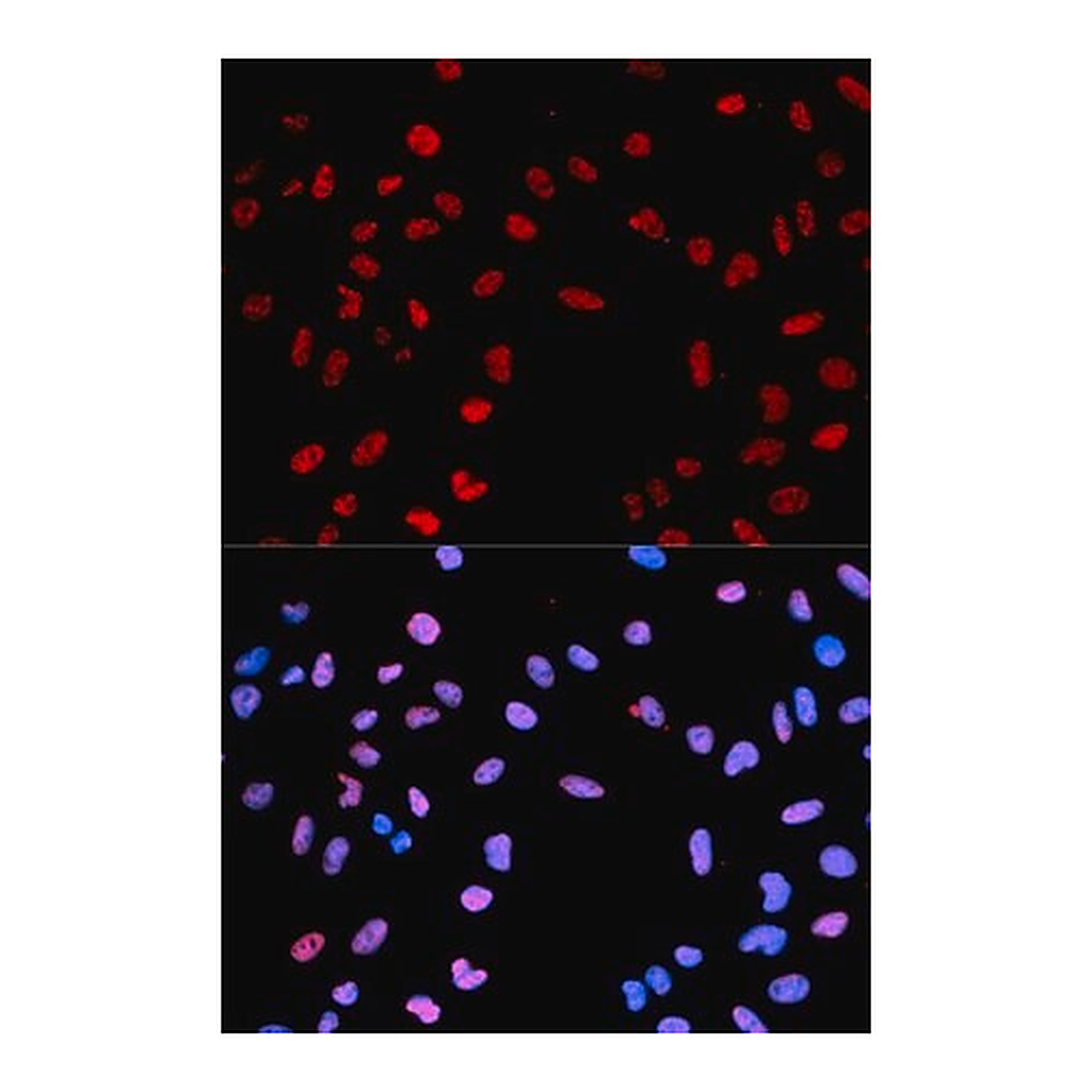 Merck Anti-Phospho-AKT1-T450 antibody produced in rabbit