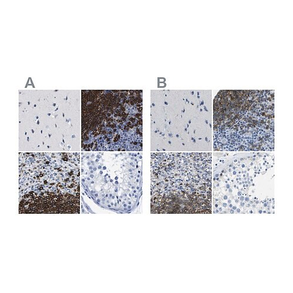 Merck Anti-MS4A1 antibody produced in rabbit