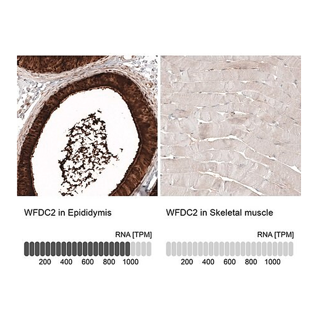Merck Anti-WFDC2 antibody produced in mouse