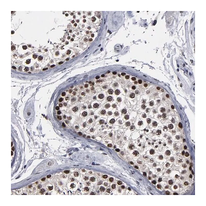 Merck Anti-SSRP1 antibody produced in rabbit