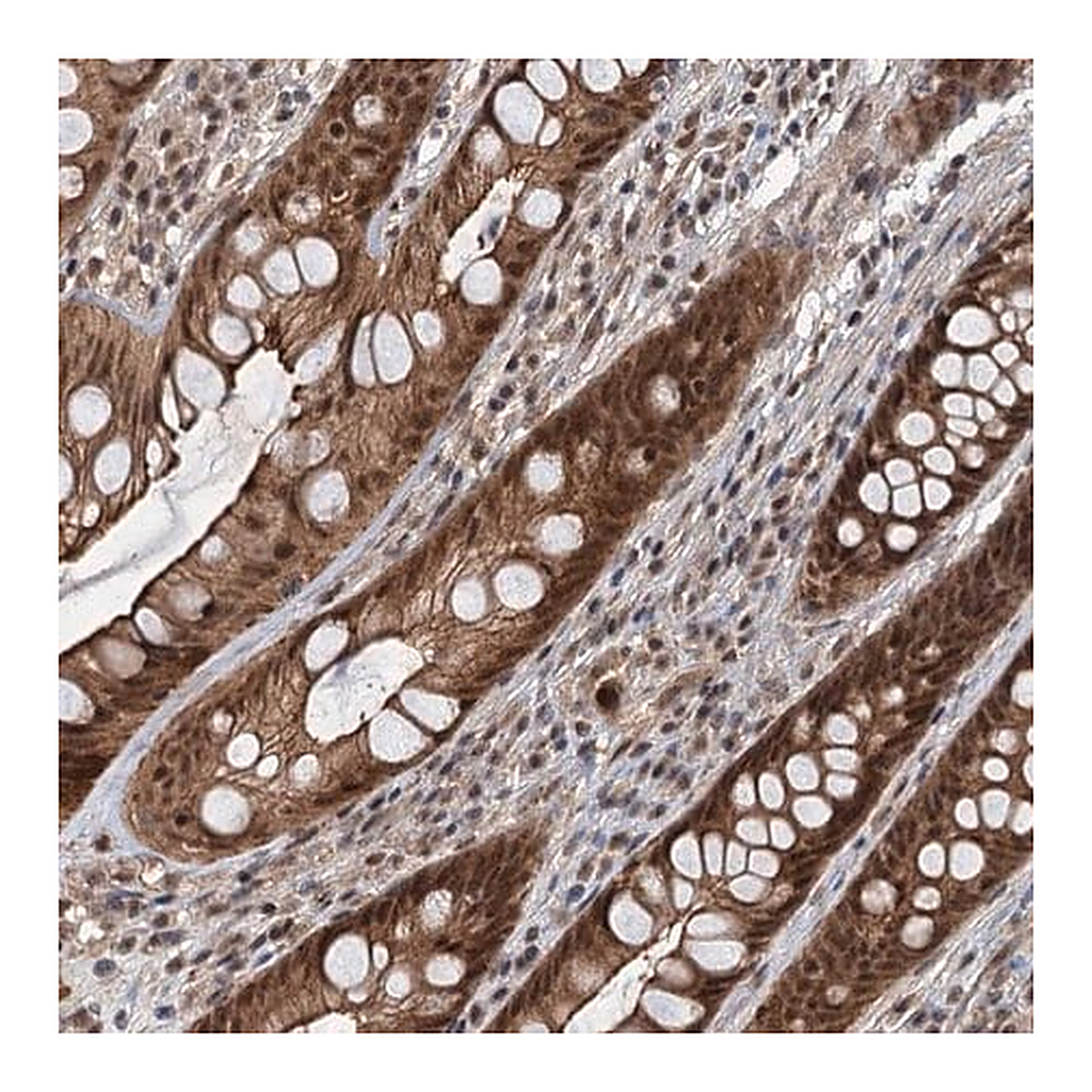 Merck Anti-RITA1 antibody produced in rabbit