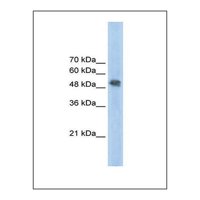 Merck Anti-FECH (Ab2) antibody produced in rabbit