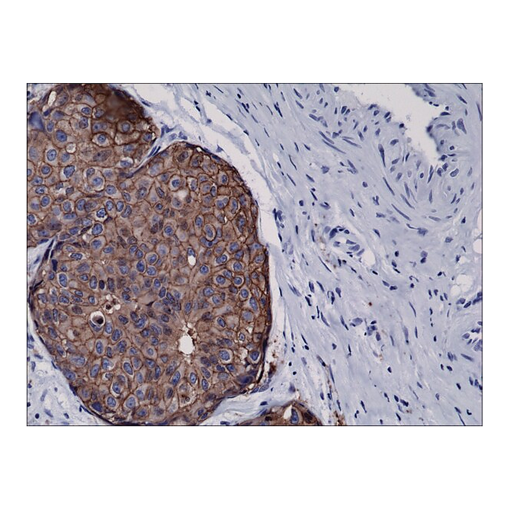 Merck Anti-HER2 antibody, Rabbit monoclonal