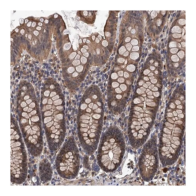 Merck Anti-LRRC2 antibody produced in rabbit