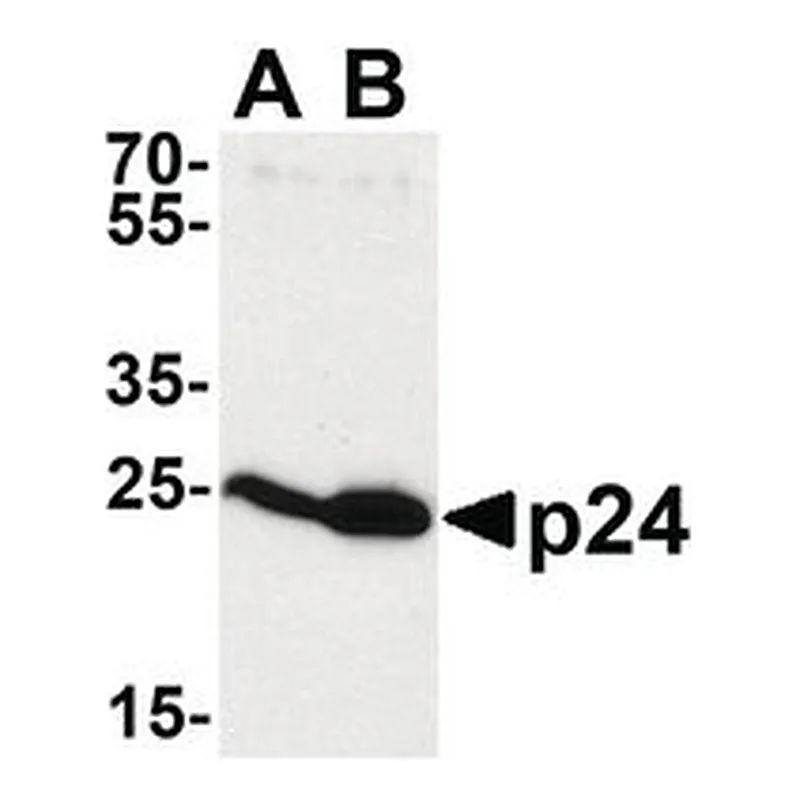 Merck ANTI-HIV-1 P24