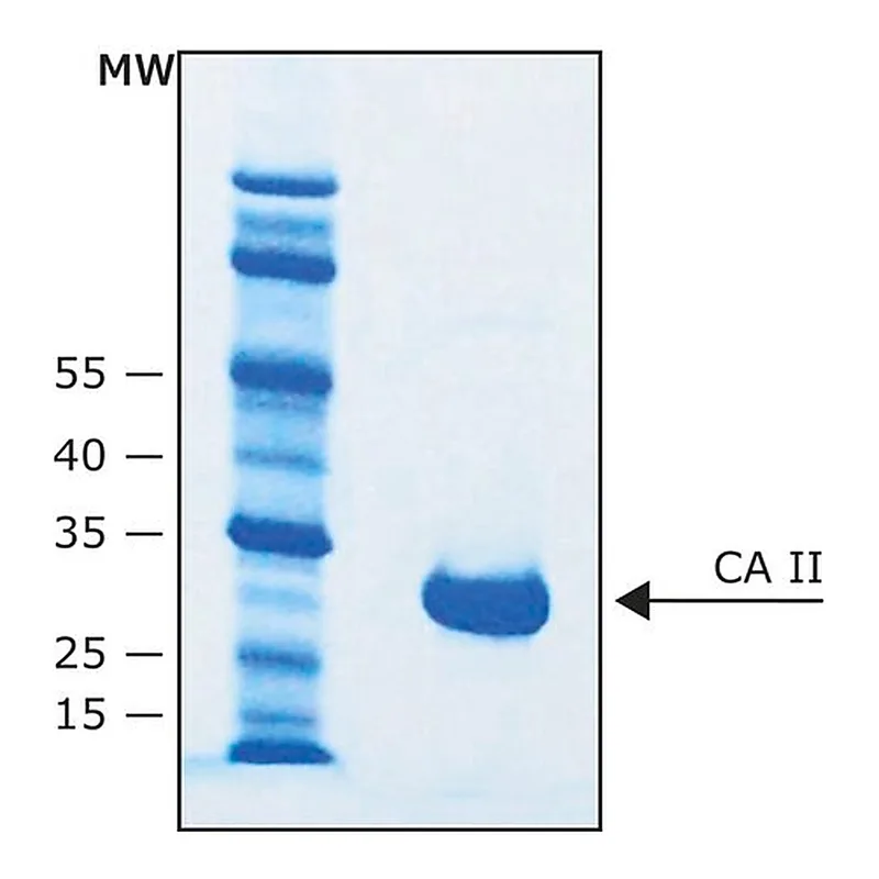 Merck Carbonic Anhydrase II bovine