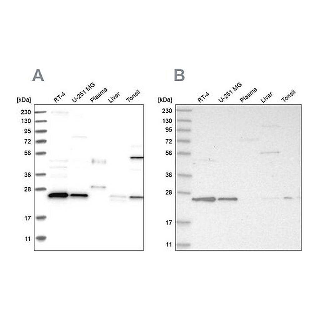 Merck Anti-VPS28 antibody produced in rabbit