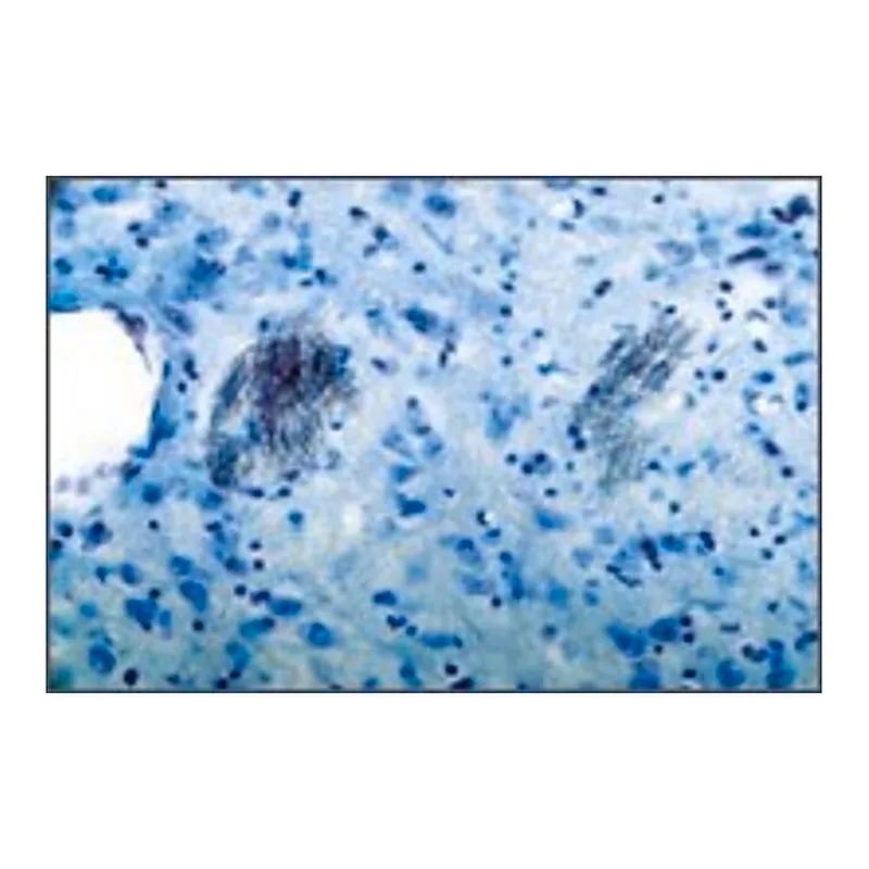 Merck Anti-Purinergic Receptor P2Y1 antibody produced in rabbit