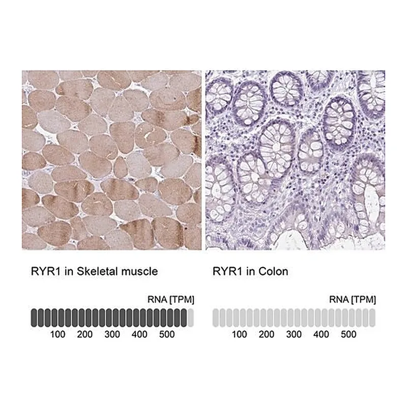 Merck Anti-RYR1 antibody produced in rabbit