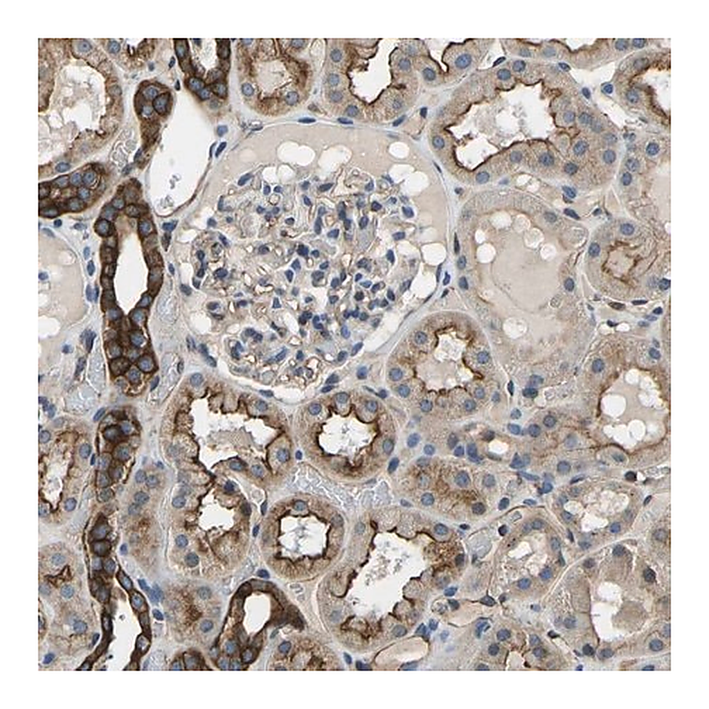 Merck Anti-KCNJ15 antibody produced in rabbit