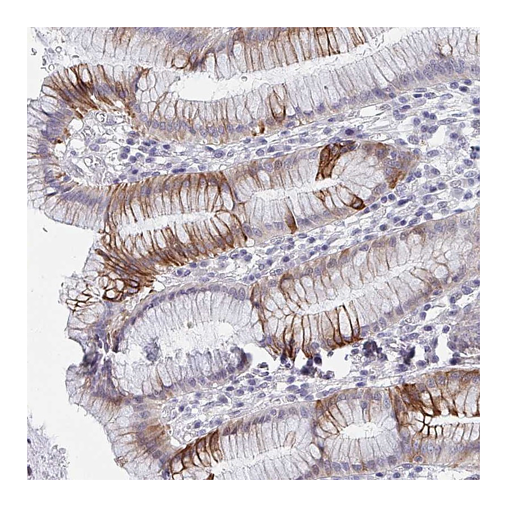 Atlas Antibodies Anti-FAM156A Antibody