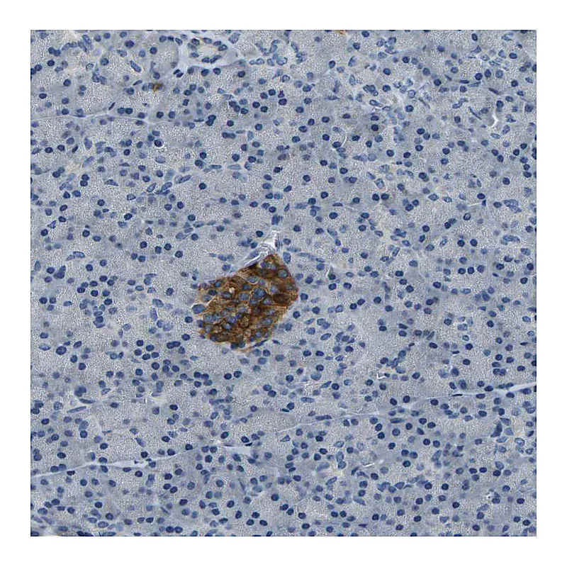 Atlas Antibodies Anti-FAM159B Antibody