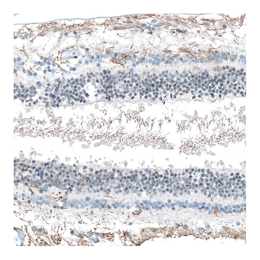 Atlas Antibodies Anti-FAM161A Antibody