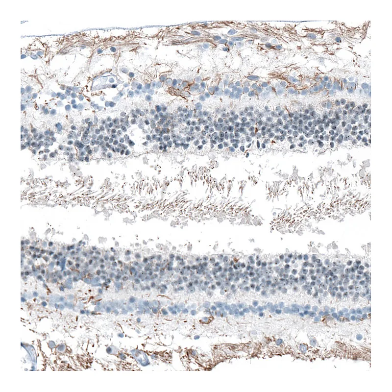 Atlas Antibodies Anti-FAM161A Antibody