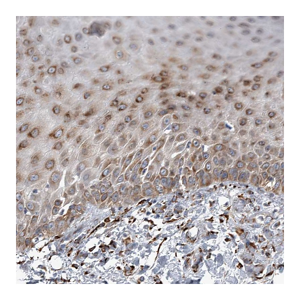 Atlas Antibodies Anti-FAM160B2 Antibody