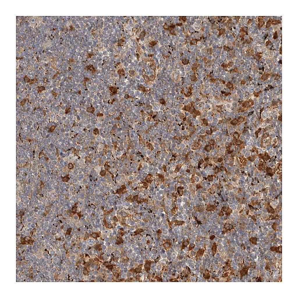 Atlas Antibodies Anti-FAM167A Antibody