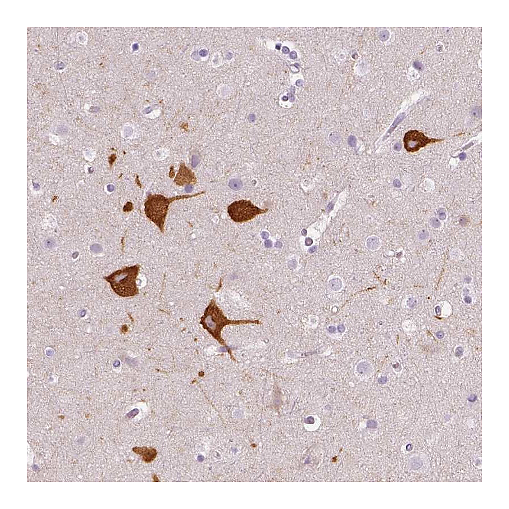 Atlas Antibodies Anti-FAM163B Antibody