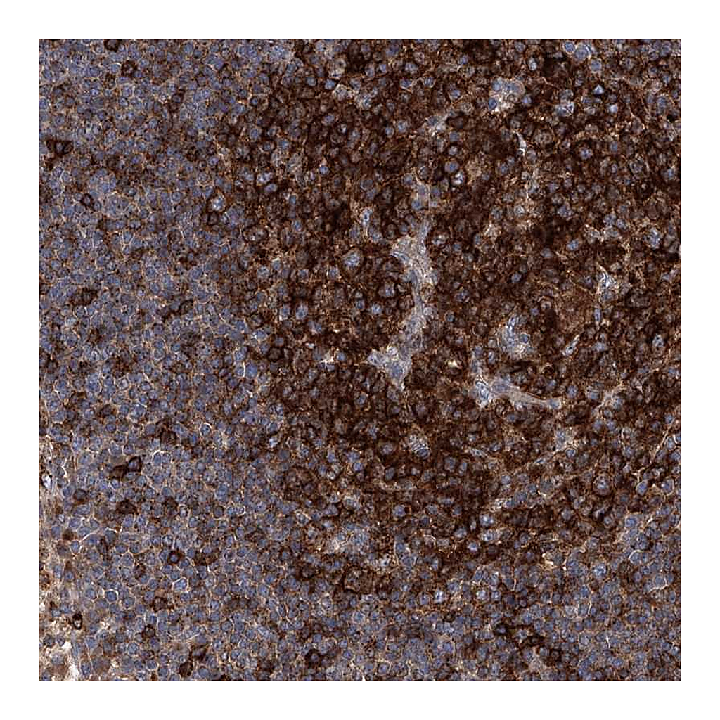 Atlas Antibodies Anti-FAM167A Antibody
