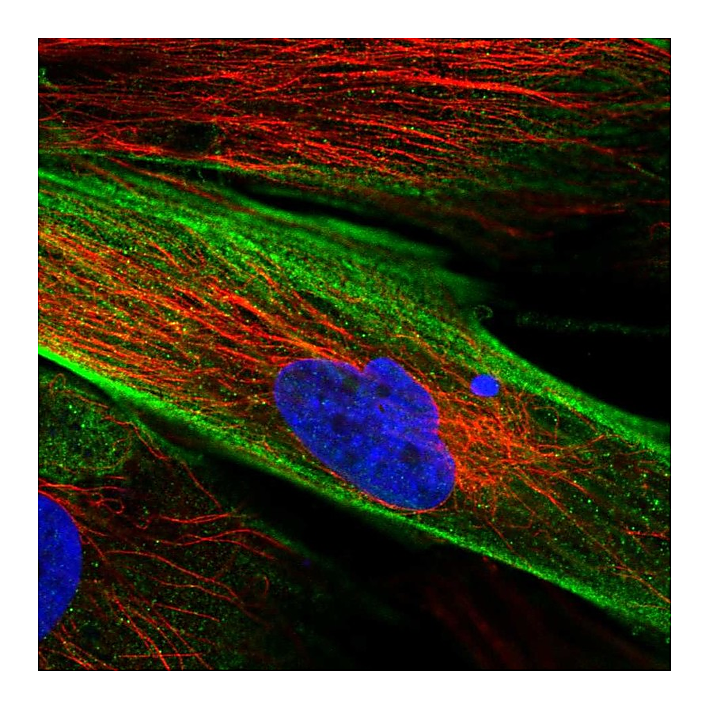 Atlas Antibodies Anti-FAM167B Antibody