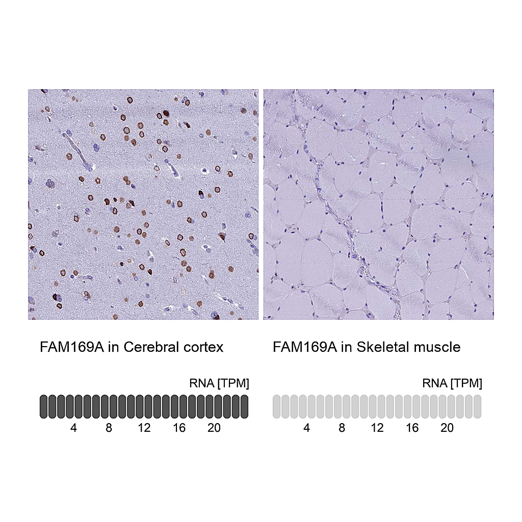 Atlas Antibodies Anti-FAM169A Antibody