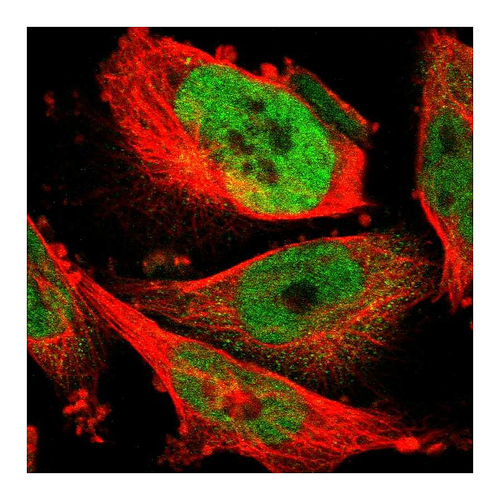 Atlas Antibodies Anti-FAM172A Antibody