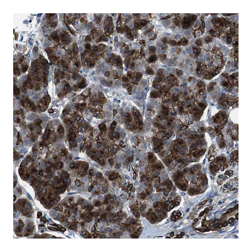 Atlas Antibodies Anti-FAM174B Antibody