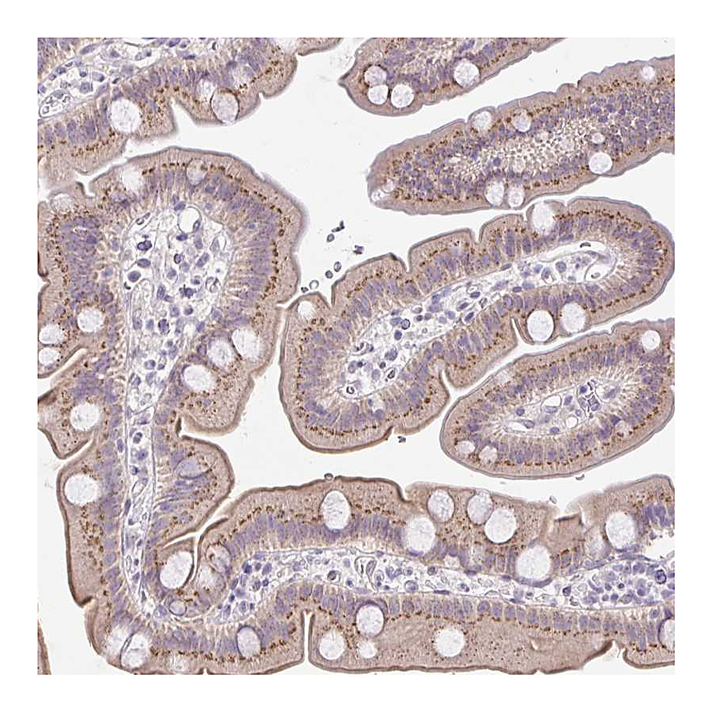 Atlas Antibodies Anti-FAM177A1 Antibody