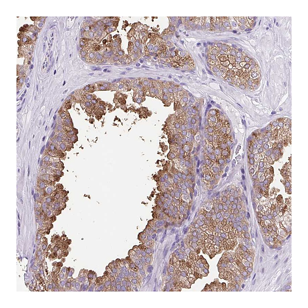 Atlas Antibodies Anti-FAM177B Antibody