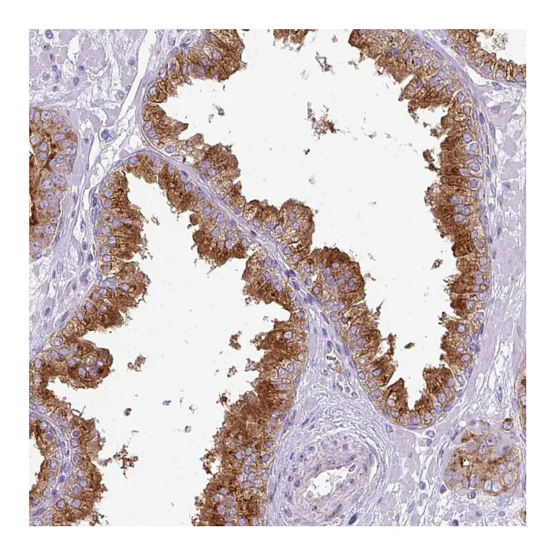 Atlas Antibodies Anti-FAM177A1 Antibody