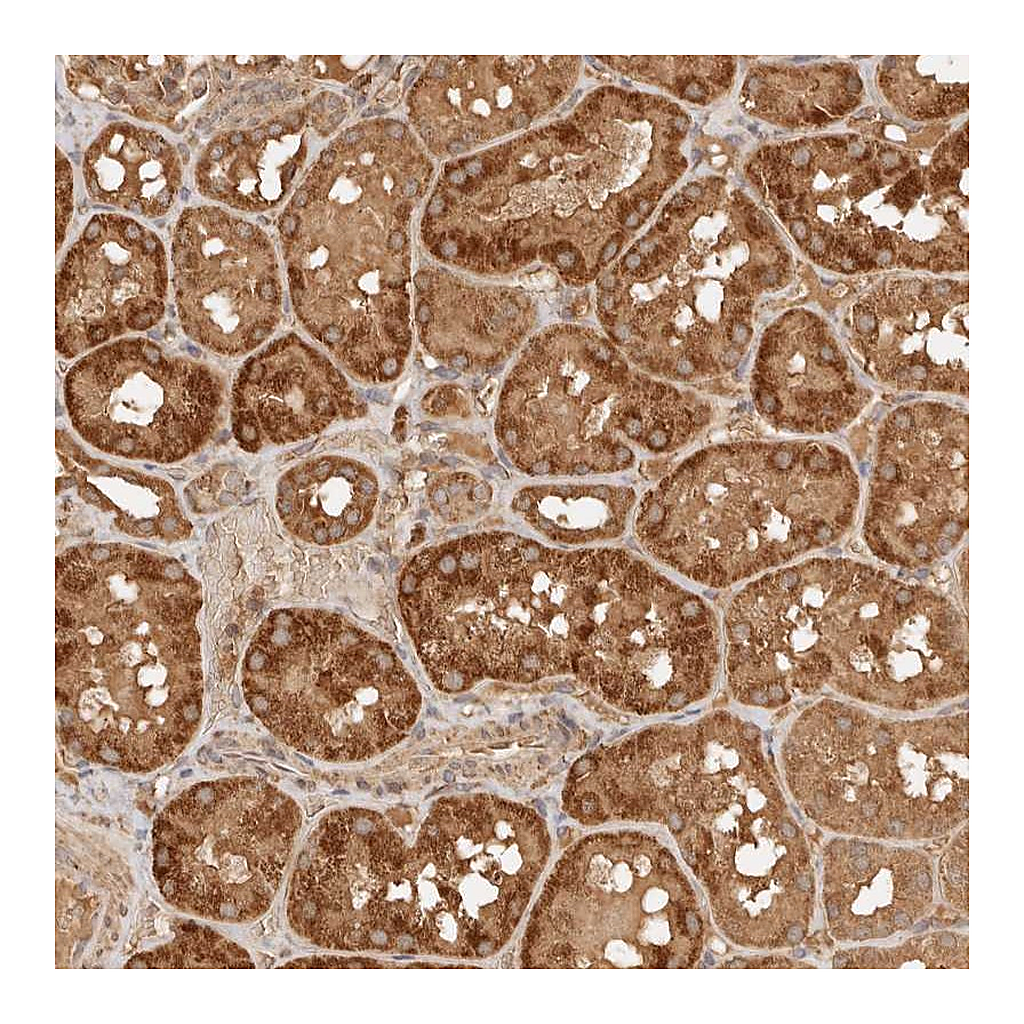 Atlas Antibodies Anti-FAM180B Antibody