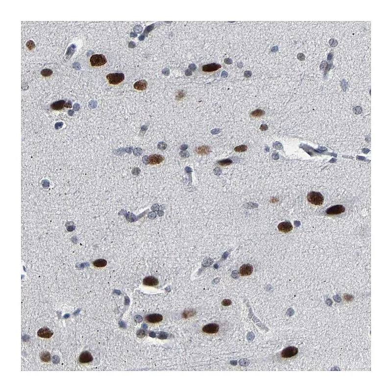 Atlas Antibodies Anti-FAM180A Antibody