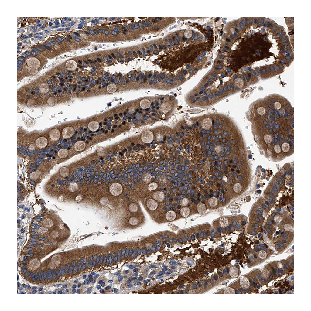 Atlas Antibodies Anti-FAM185A Antibody