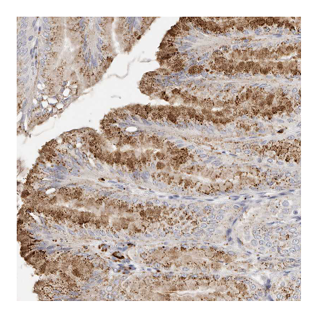Atlas Antibodies Anti-FAM185A Antibody