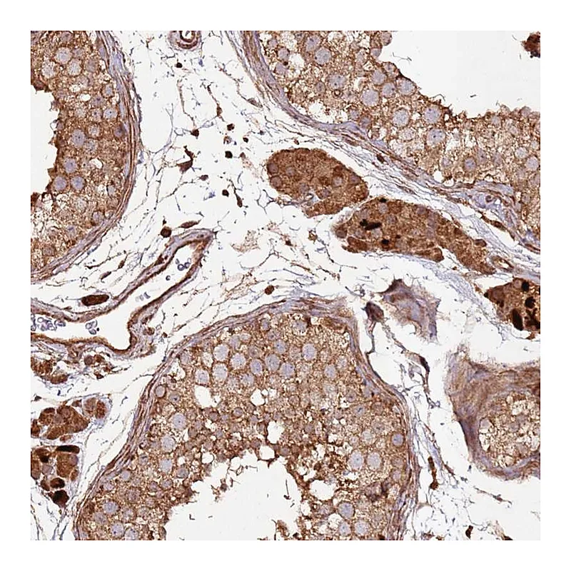 Atlas Antibodies Anti-FAM186A Antibody