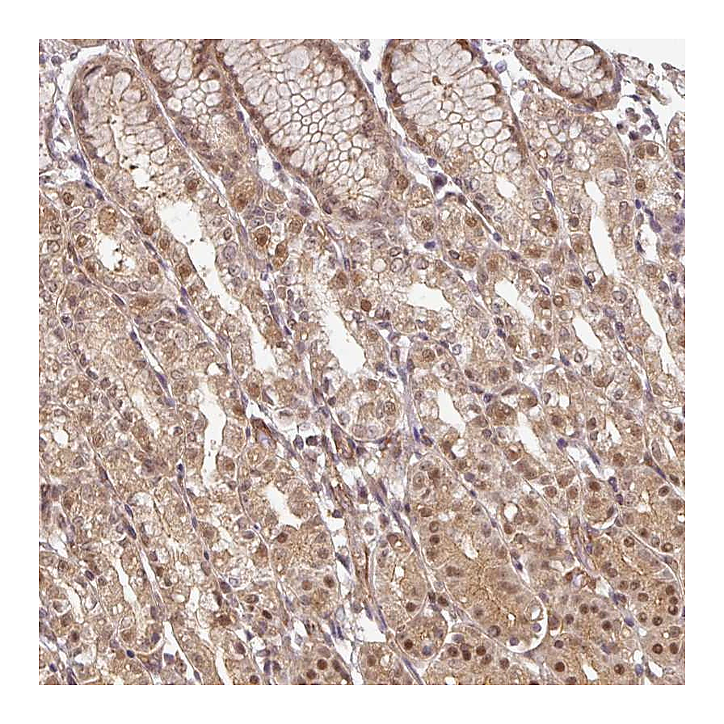 Atlas Antibodies Anti-FAM192A Antibody