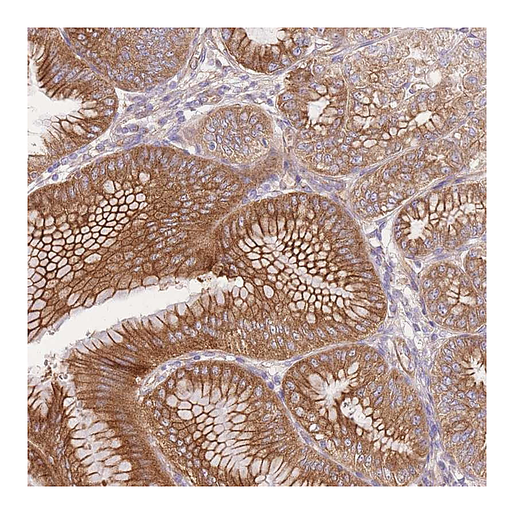 Atlas Antibodies Anti-FAM196B Antibody
