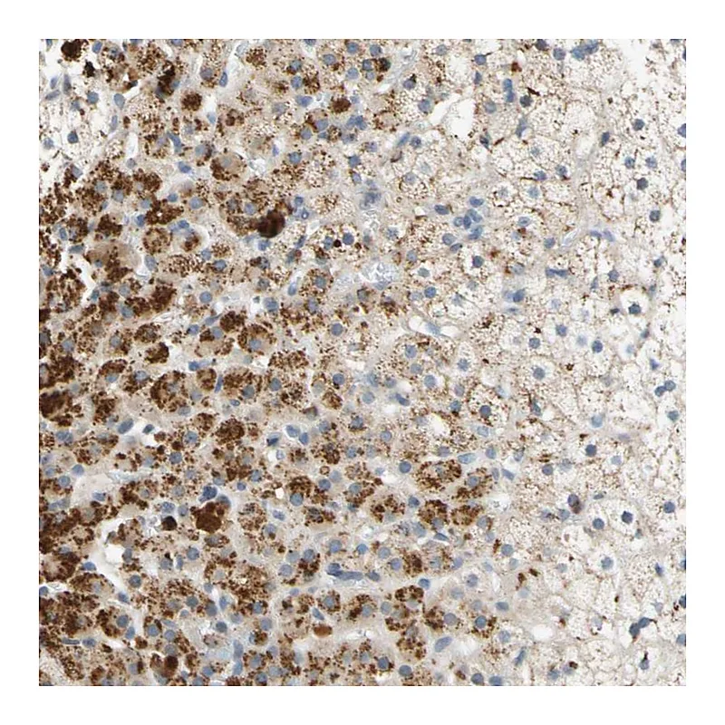 Atlas Antibodies Anti-FAM198B Antibody