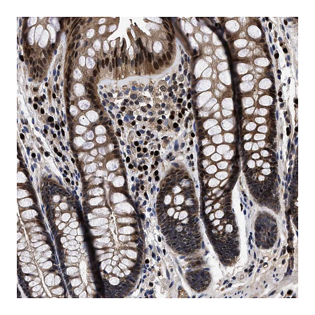 Atlas Antibodies Anti-FAM200A Antibody