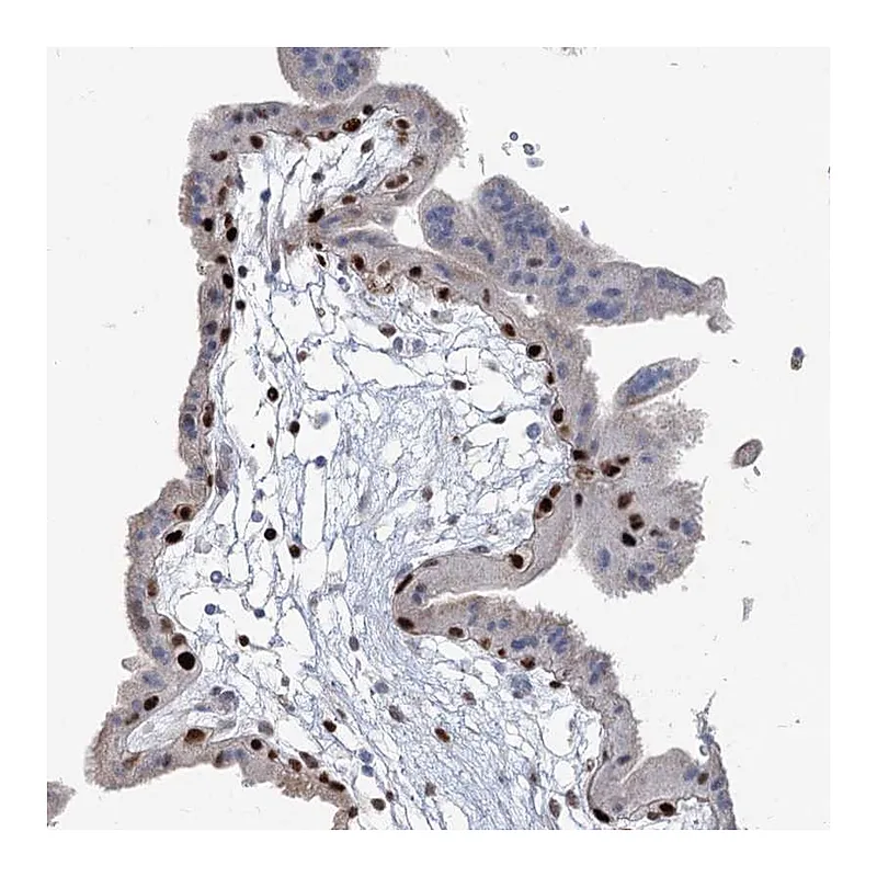 Atlas Antibodies Anti-FAM206A Antibody
