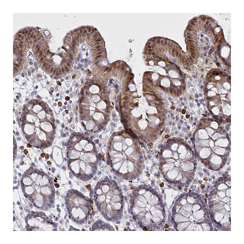 Atlas Antibodies Anti-FAM206A Antibody