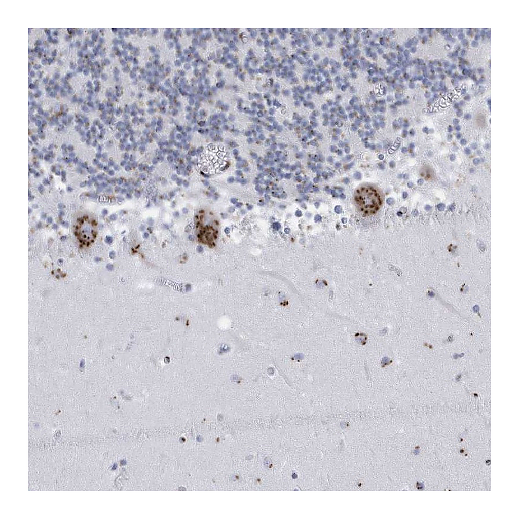 Atlas Antibodies Anti-FAM207A Antibody